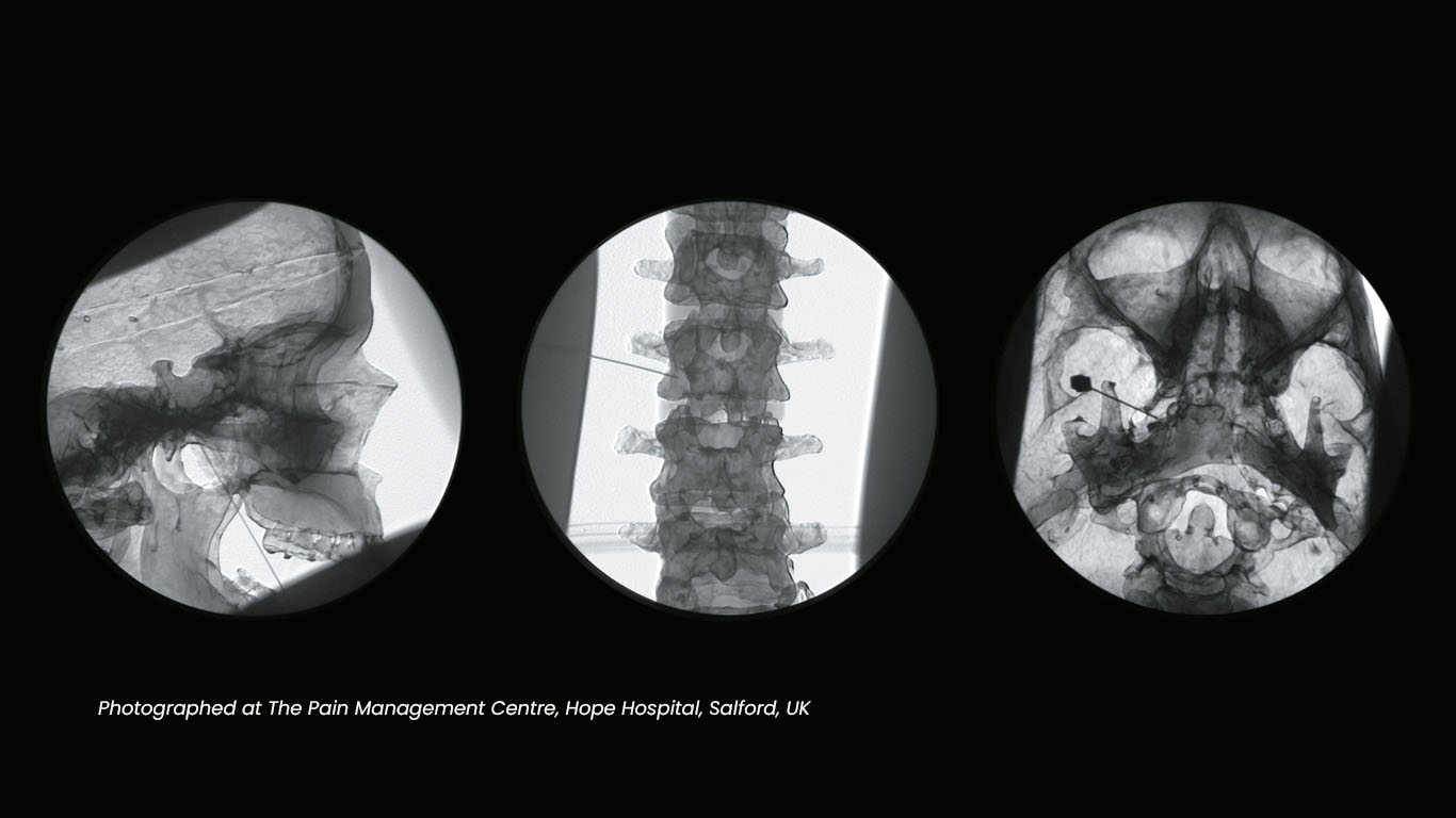Nerve Block/Pain Relief Manikin Adam,Rouilly