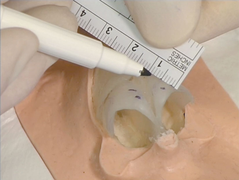 Rhinoplasty Model | Adam Rouilly