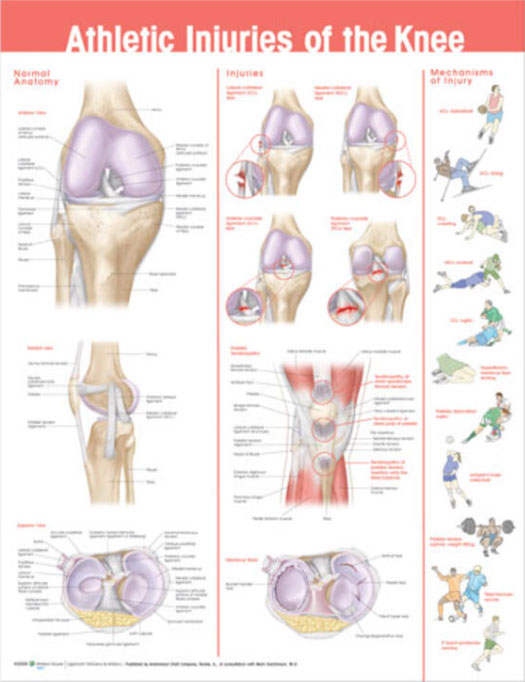Athletic Injuries Of The Knee Chart | Adam,Rouilly