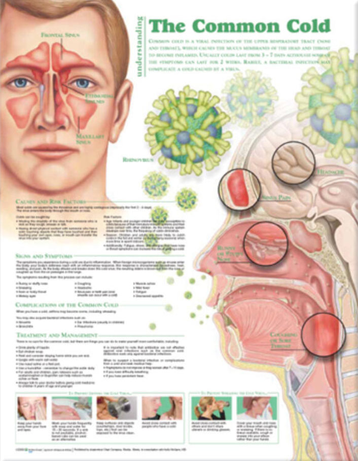 Understanding The Common Cold Chart | Adam,Rouilly