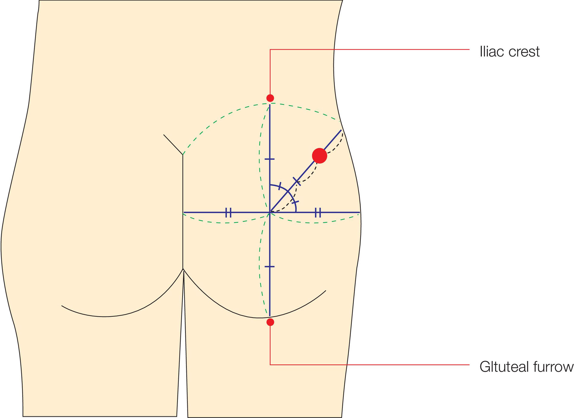 Koken Dorsogluteal Intramuscular Injection Model | Adam,Rouilly