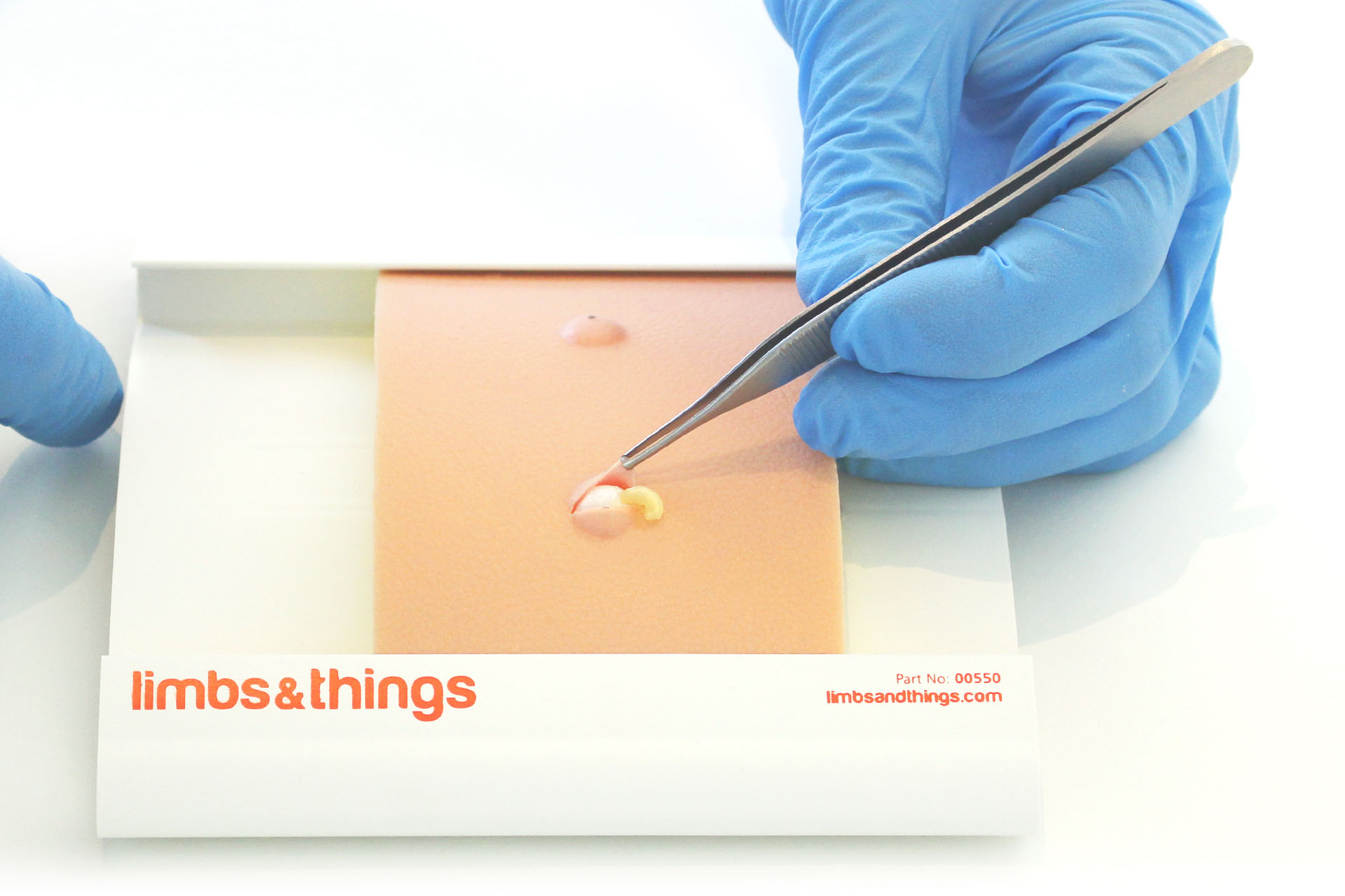 Sebaceous Cyst Pad Adam,Rouilly