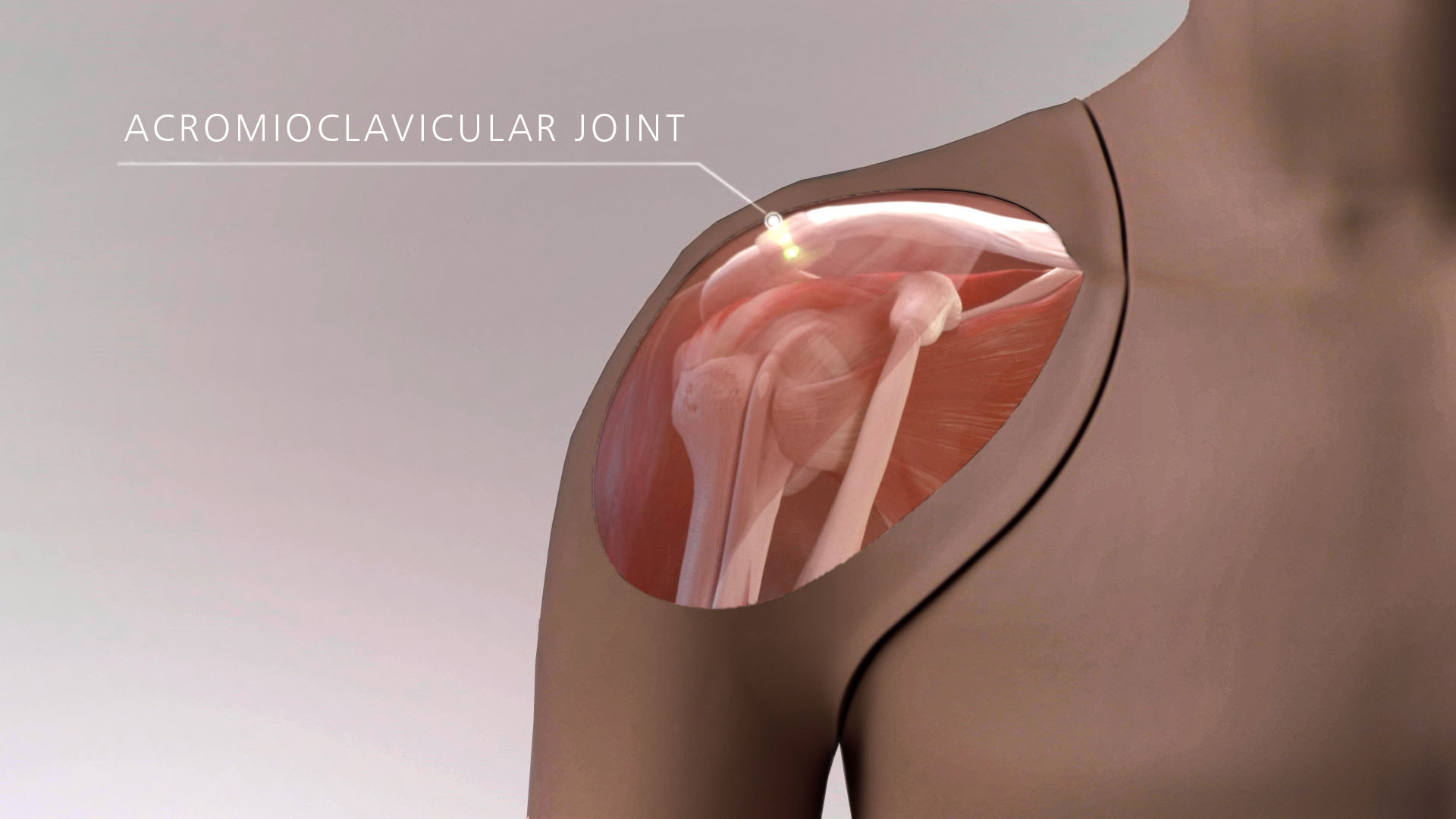 Shoulder Injection Trainer Ultrasound Guided, Dark - Adam,Rouilly