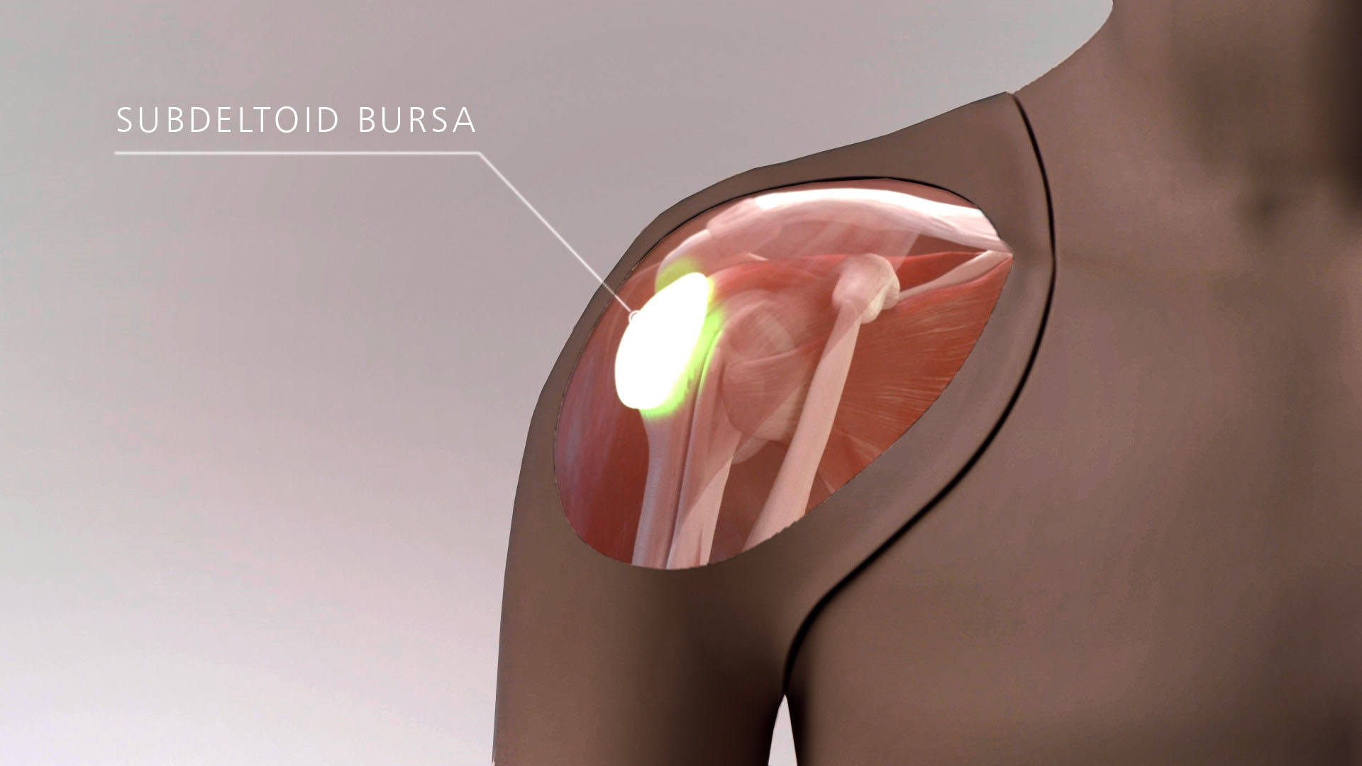 Shoulder Injection Trainer Ultrasound Guided, Dark - Adam,Rouilly