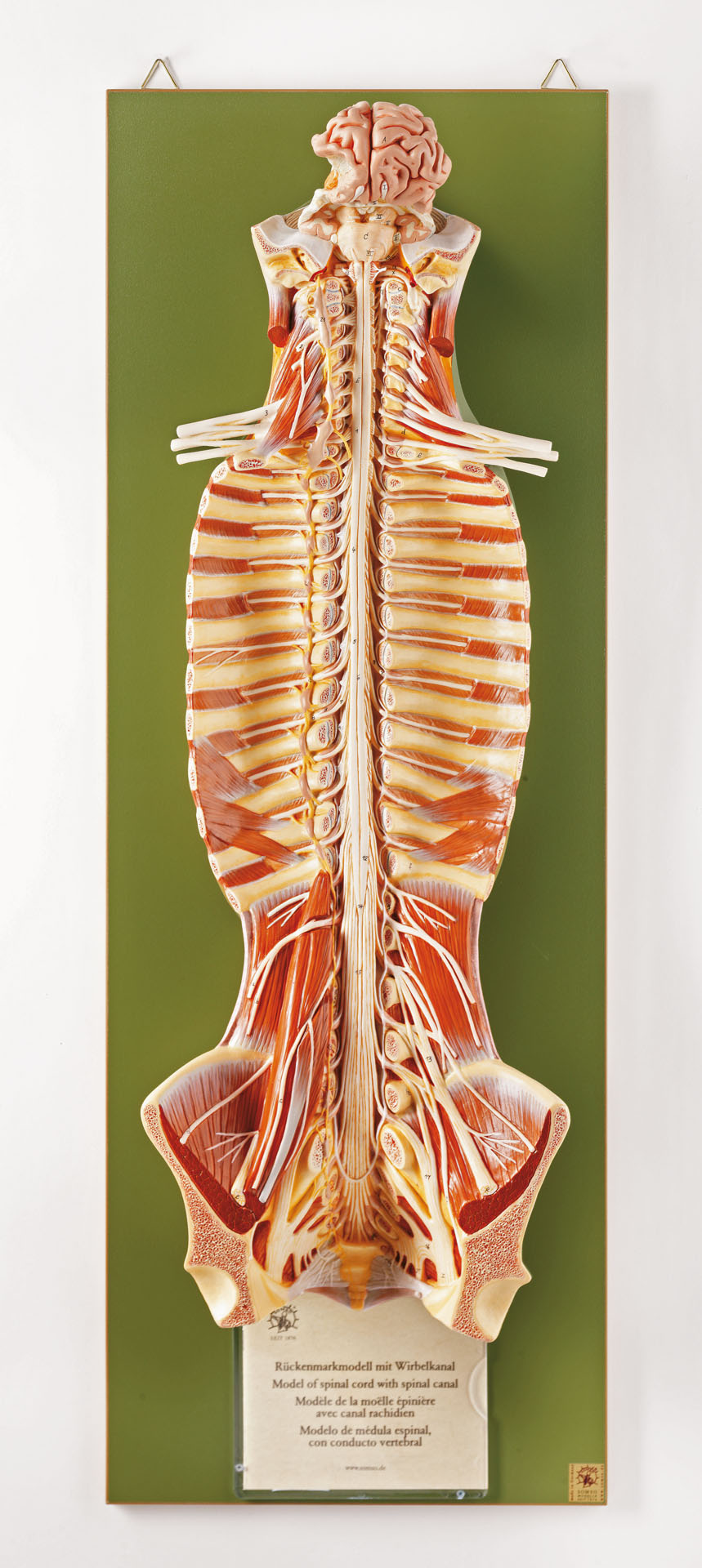 Spinal Cord in the Spinal Canal, Light - Adam,Rouilly