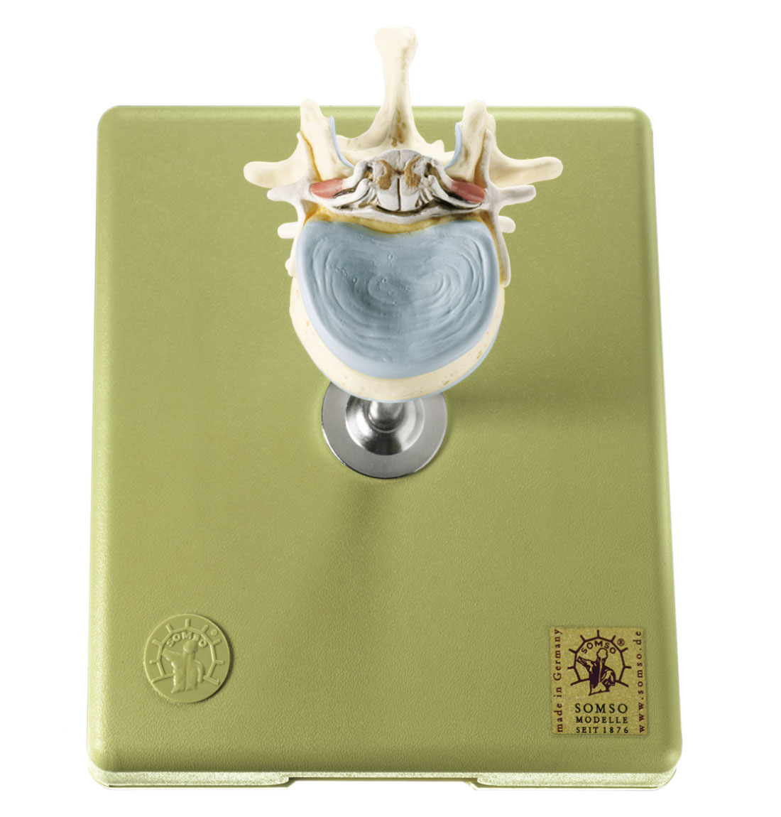 Lumbar Vertebra (L II) With Lumbar Region of Spinal Cord - Adam,Rouilly