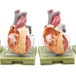 Series of Models Representing Congenital Organic Heart Diseases - Adam ...