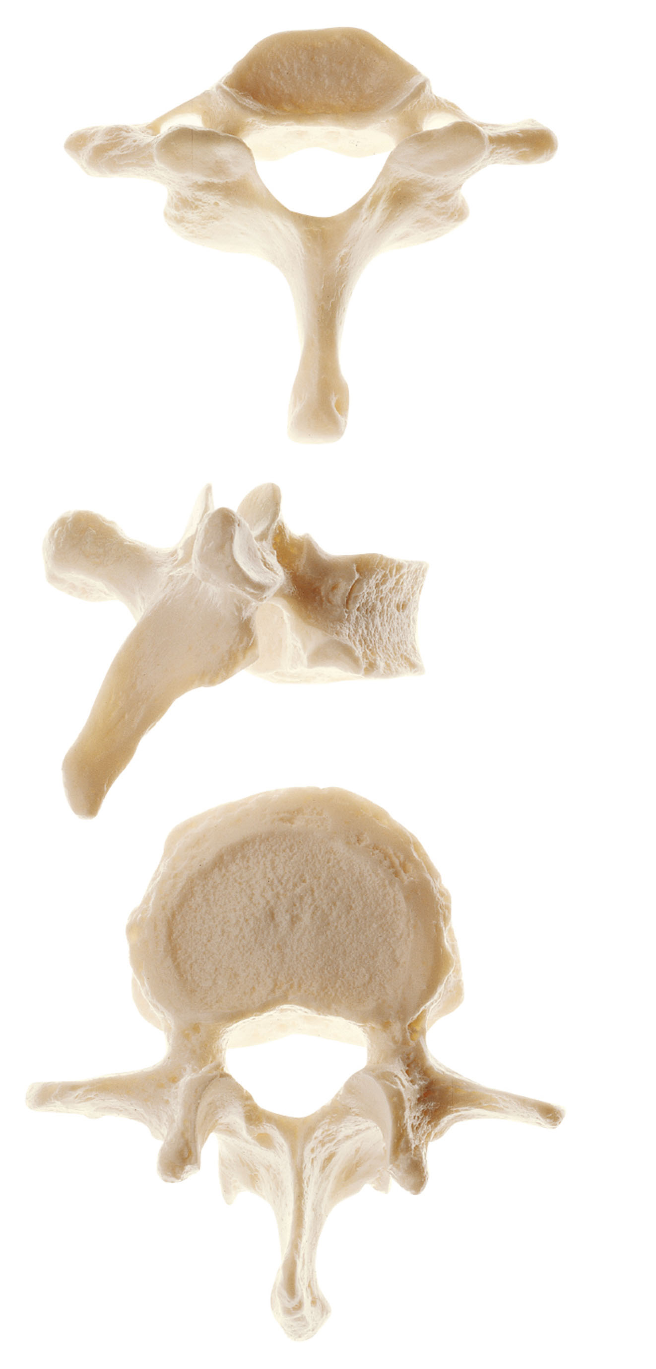 Vertebra (Cervical, Thoracic or Lumbar) - Adam,Rouilly